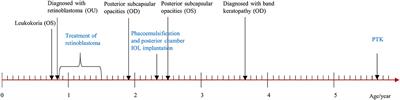 Case Report: Phototherapeutic Keratectomy for Band Keratopathy Secondary to Chemo-Laser-Cryotherapy for Retinoblastoma